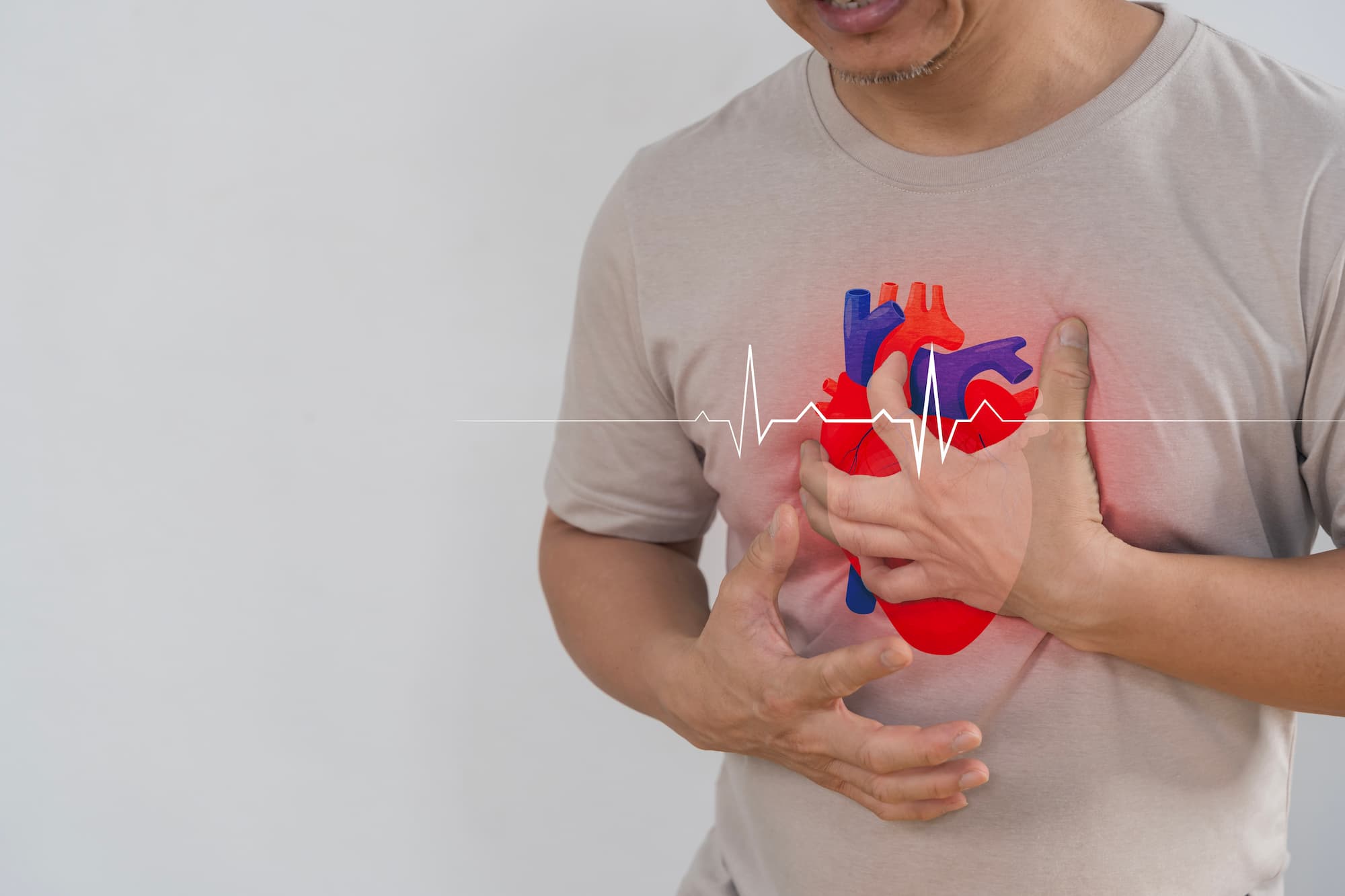 a man with arrhythmia